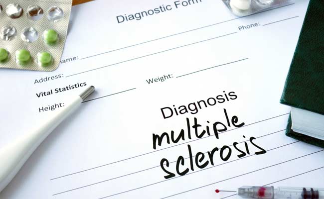 New Drug To Stop Advance Of Multiple Sclerosis