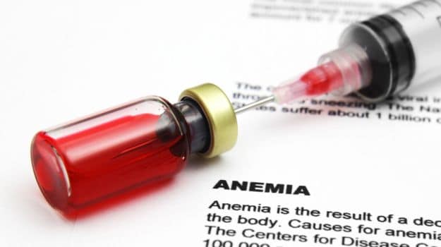 Anemia: Signs, Symptoms, Deficiency, Diagnosis, Causes and Prevention