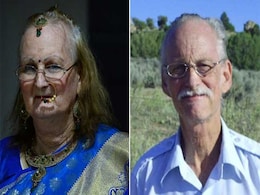 Sex-Change Surgery: India's New Line In Budget Medical Tourism Sex-Change Surgery: India's New Line In Budget Medical Tourism