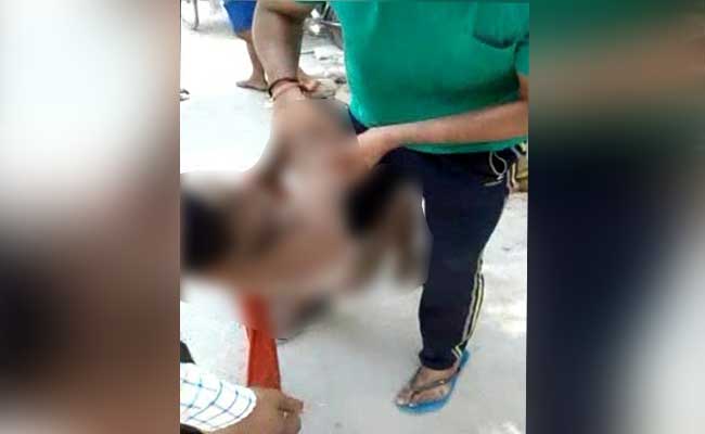 16-Year-Old Thrashed, Stripped, Brutalised With Beer Bottles In Delhi