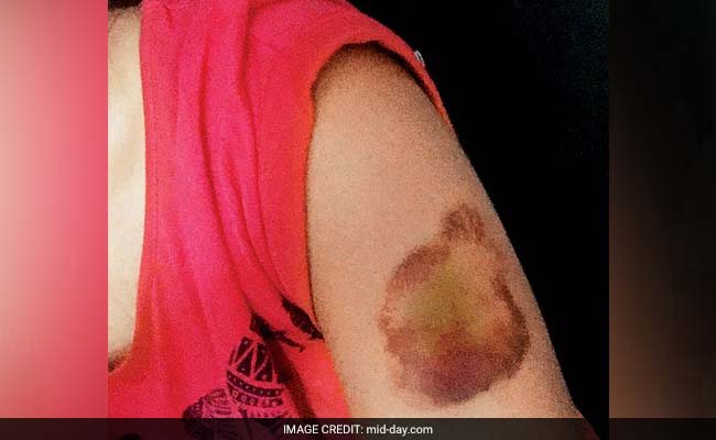Pune: Woman Thrashed For 'Wearing Short Dress, Roaming With Men'