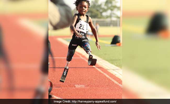 This 10-Year-Old Amputee Plays Cricket, Thanks To Bionic Legs