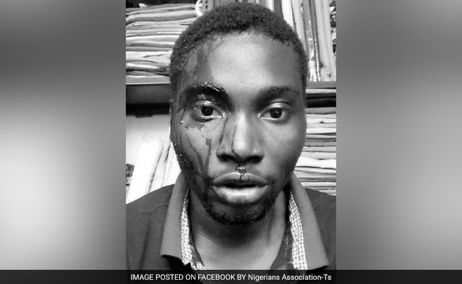 Nigerian Student Allegedly Assaulted In Hyderabad Over Parking Dispute
