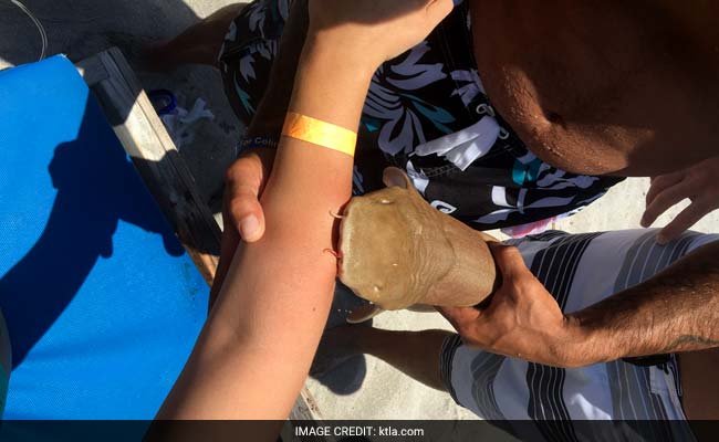 'It Wasn't Letting Go': Woman Rushed To Hospital With A Shark Attached To Her Arm