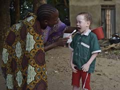 Africa Summit Tackles Violence Against Albinos