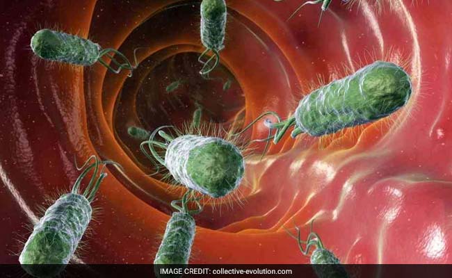 Out-Of-Balance Gut Bacteria Connected To Multiple Sclerosis: Study
