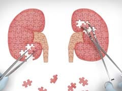 Kidney Failure Patients On Dialysis At Early Death Risk