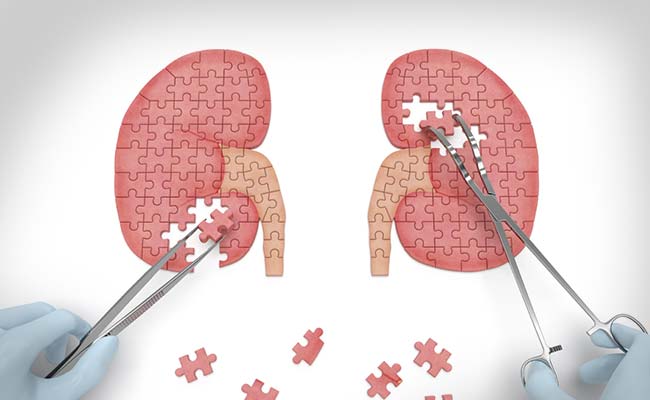 Chinese 17-Year-Old Found With 4 Kidneys