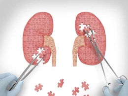 Kidney Racket: 22-Year-Old Recipient Arrested From Delhi Hospital Kidney Racket: 22-Year-Old Recipient Arrested From Delhi Hospital