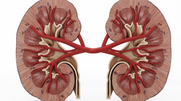 Wearable Artificial Kidney Could Replace Conventional Dialysis