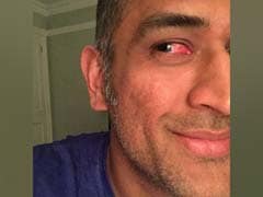 When an Injured MS Dhoni Kept Wicket Despite Blurry Vision and Pain