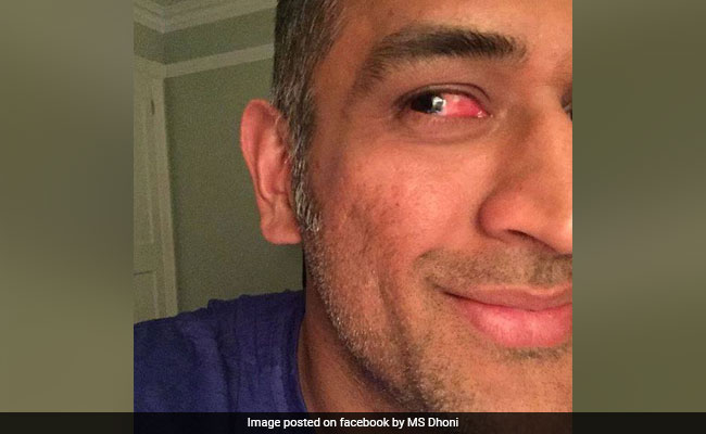 When an Injured MS Dhoni Kept Wicket Despite Blurry Vision and Pain