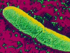 Study Reveals How Plague Bacteria Sparked Global Pandemics