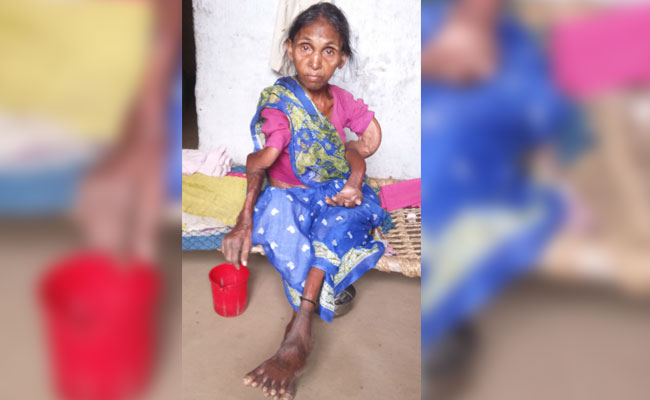 36 Dead In Jharkhand Village Of Skeletal Fluorosis