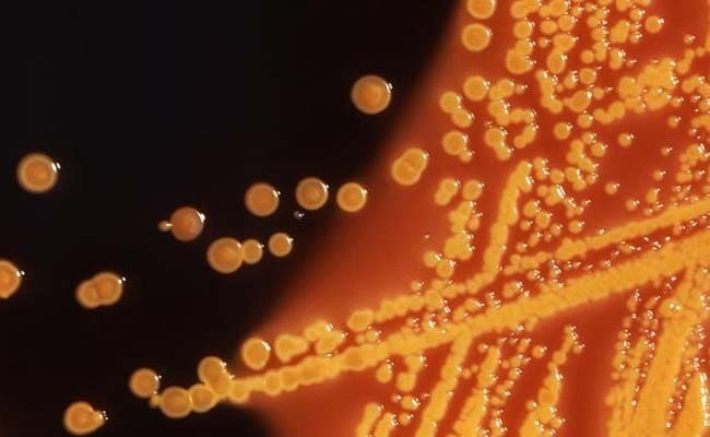 Researchers Find Second 'Superbug' Gene In US Patient