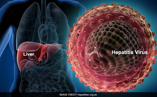 Hepatitis Outstrips AIDS, TB As Killer: Report