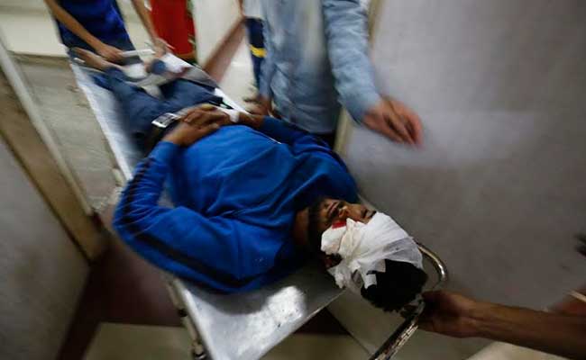 ये पैलेट गन क्या है और क्यों पुलिस और सीआरपीएफ ने प्रदर्शनकारियों पर इसका इस्तेमाल किया?