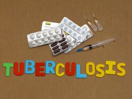 World TB Day: सिर्फ यूपी में 14 हजार बच्चे टीबी की चपेट में, ये हैं इस बिमारी के लक्षण World TB Day: सिर्फ यूपी में 14 हजार बच्चे टीबी की चपेट में, ये हैं इस बिमारी के लक्षण