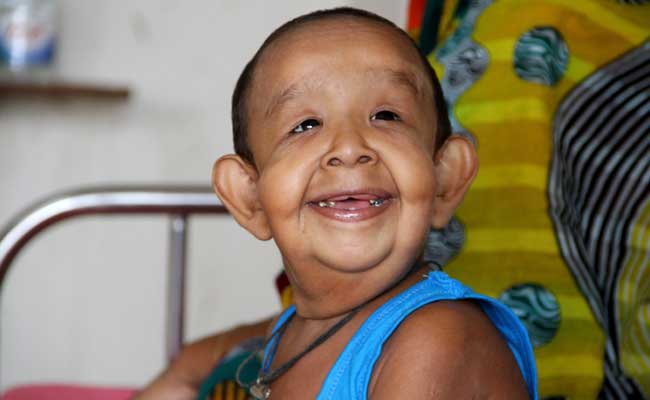Bangladeshi Boy With 'Old Man' Illness Baffles Doctors