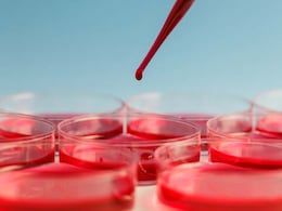 Artificial Intelligence Used To Detect Rare Leukemia Type In Japan Artificial Intelligence Used To Detect Rare Leukemia Type In Japan