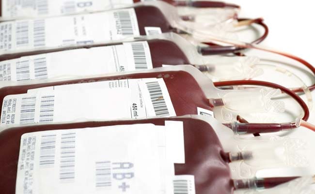 Madhya Pradesh Hospital Under Probe As 4 Children With Thalassemia Test HIV Positive