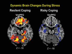 Yale Researchers Find The Part Of The Brain That Determines How Well You Handle Stress