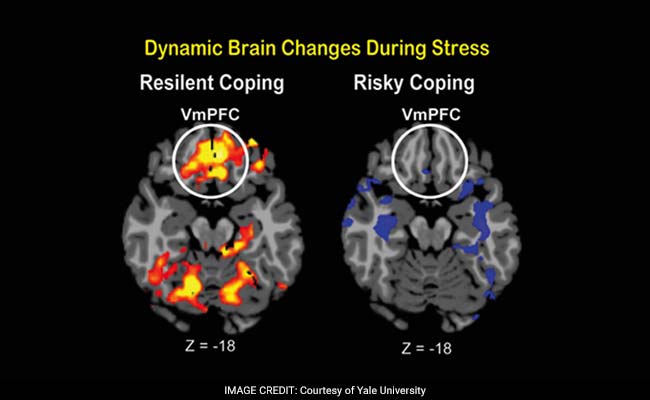 Yale Researchers Find The Part Of The Brain That Determines How Well You Handle Stress