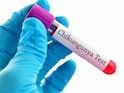 Safe, Potent Chikungunya Vaccine Developed