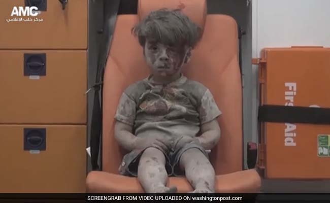 The Stunned, Bloodied Face Of A Child Survivor Sums Up The Horror Of Aleppo