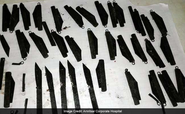 40 Knives Found In Amritsar Patient's Stomach, He's Fine Now: Foreign Media