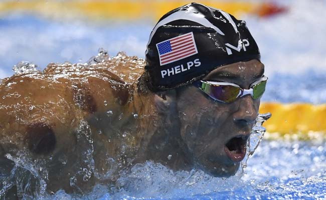 Here's Why Michael Phelps Has Those Spots On His Body