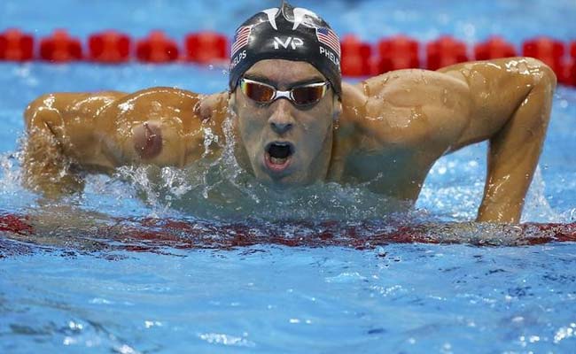 Why Does Michael Phelps Have Purple Spots On His Back?