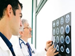 Most Fatal Type of Stroke Declining Along With Smoking Rates Most Fatal Type of Stroke Declining Along With Smoking Rates