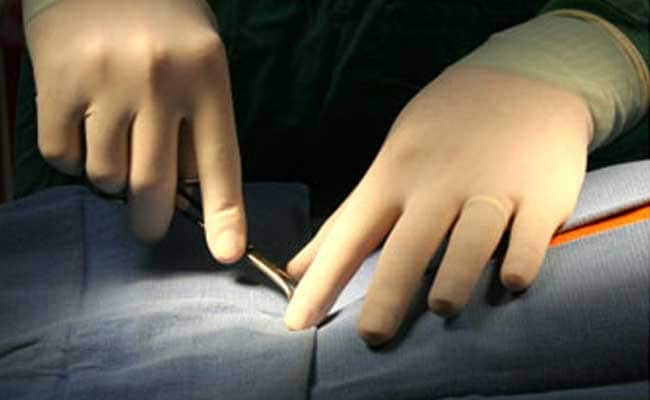 Delhi Doctors Remove Toes From 10-Year-Old, Attach Them To His Hand