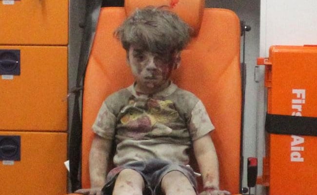Brother Of Syrian Boy Pictured In Aleppo Dies Of His Wounds