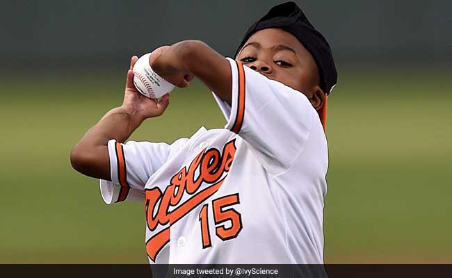 Boy Shows Off New Hands A Year After Double-Hand Transplant