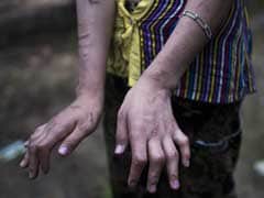 Beaten And Burnt: Myanmar's Invisible Child Servants
