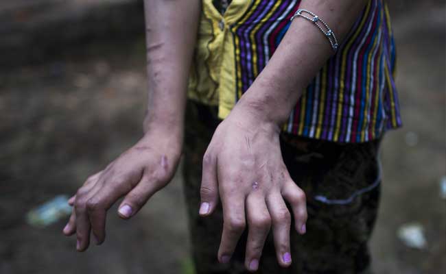 Beaten And Burnt: Myanmar's Invisible Child Servants