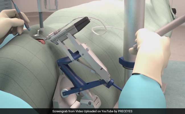 Robot Operates Inside Eyes For First Time