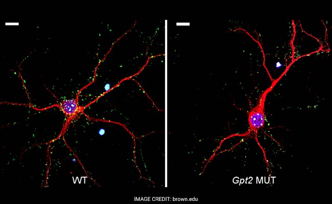 Gene Mutation Behind Rare, New Brain Disorder Identified