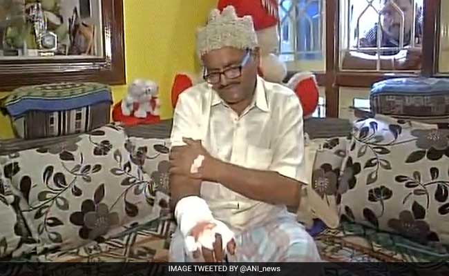 For Refusing To Sign Inflated Bills, His Hands Were Nearly Chopped Off