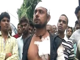 RJD Lawmaker's Son Allegedly Stabs Man For Overtaking His Car, Arrested RJD Lawmaker's Son Allegedly Stabs Man For Overtaking His Car, Arrested