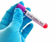 Scrub Typhus Claims 24 Lives In Himachal