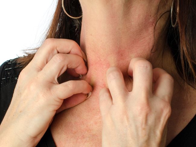 Image result for skin diseases highlight internal problems