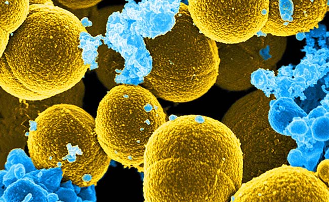Hundreds Struggling With "Superbug" In UK To Be Given Faecal Transplants: Report