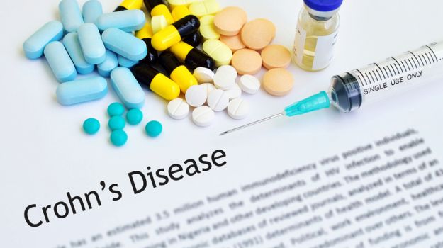 Food-Poisoning Bacteria Responsible for Crohn's Disease: Study