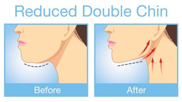 How to Get Rid of a Double Chin: 5 Easy Exercises - NDTV Food