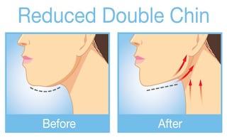 How to Get Rid of a Double Chin: 5 Easy Exercises