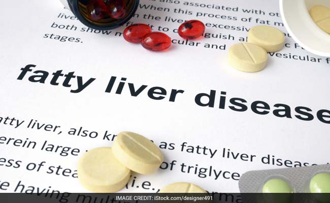 fatty liver disease