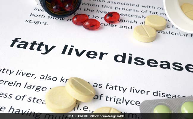 5 natural ways to fight non-alcoholic fatty liver disease – Asian Tribune